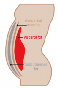 fat background for non invasive liposuction