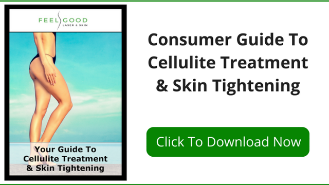 Say goodbye to cellulite